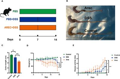 Arecoline aggravates acute ulcerative colitis in mice by affecting intestinal microbiota and serum metabolites